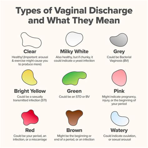 Recognizing Different Types of Discharge