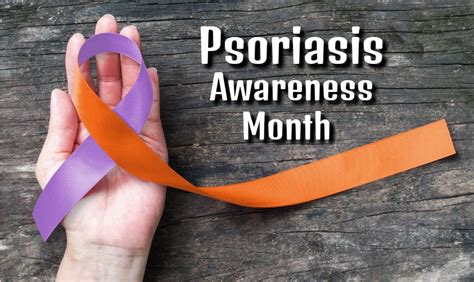 Recognizing Psoriasis in a 3-Month-Old