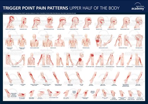 Recognizing the Pain Patterns