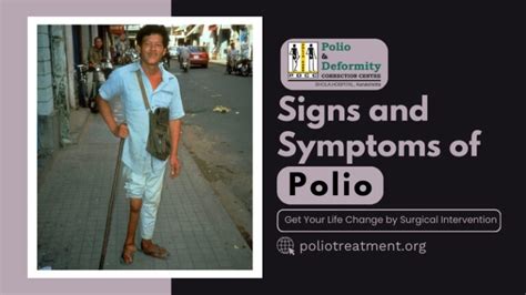 Recognizing the Signs of Polio