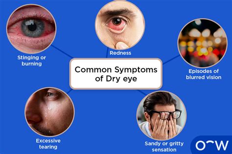 Recognizing the Symptoms of Post-Conjunctivitis Dryness