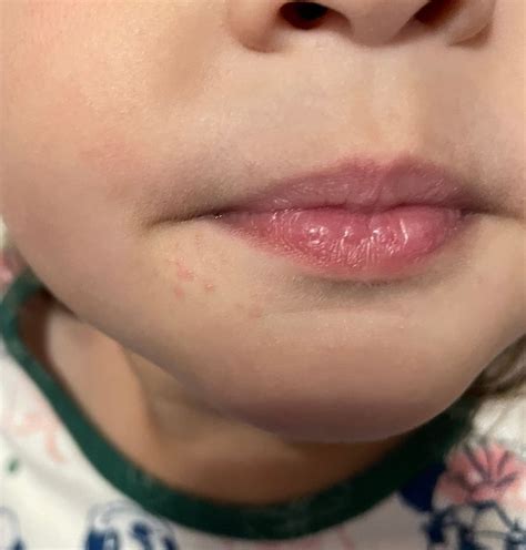 Red Dot On Lip Child