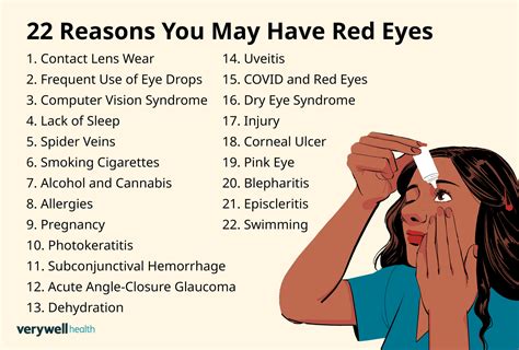 Red Eye Relief: Causes & Effective Treatments