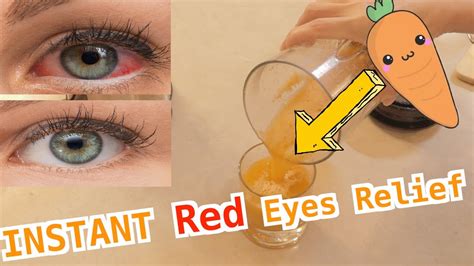 Red Eyes: Fast Relief & Effective Treatments