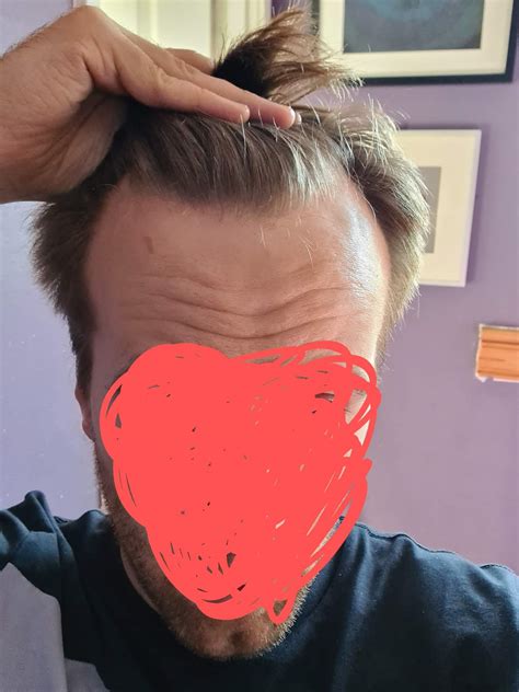 Reddit Male Grooming Hair Style