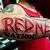 Redneck Tattoo Removal