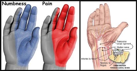 Relieve Numbness & Tingling: Effective, Safe Remedies