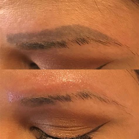 Microblading & Eyebrow Tattoo Removal Clean Slate Laser