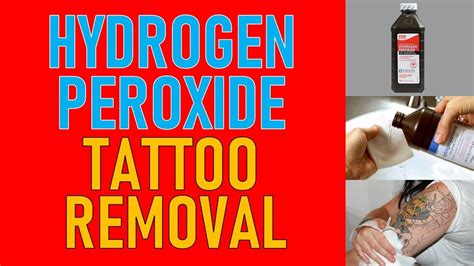 First Session Tattoo Removal using Hydrogen Peroxide YouTube