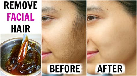 Remove Face Hair
