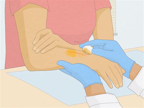 Remove Iodine From Skin