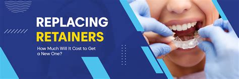 Different types of retainers