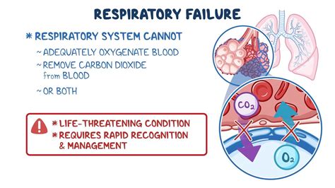 Respiratory Failure