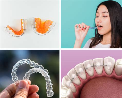 Retainers: Types & Cleaning for a Perfect Smile.