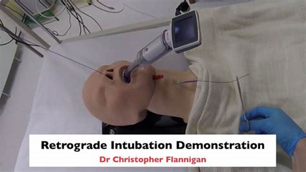 Retrograde Intubation Video