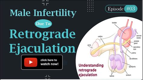 Retrograde Ejaculation