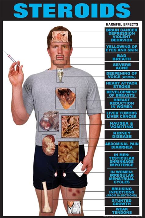Risks of Steroid Use