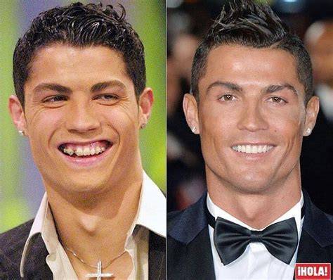Ronaldo Before Surgery