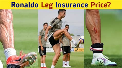 Ronaldo Leg Insurance