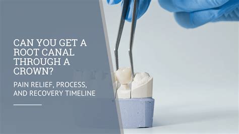 Root Canal: Relief, Recovery & Lasting Health