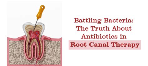 Root Canal Antibiotics