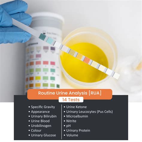 Routine Urine Analysis