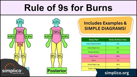 Rule Of 9 Chart