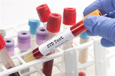 STD Testing