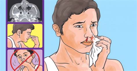 Safety First: Common Mistakes and Side Effects