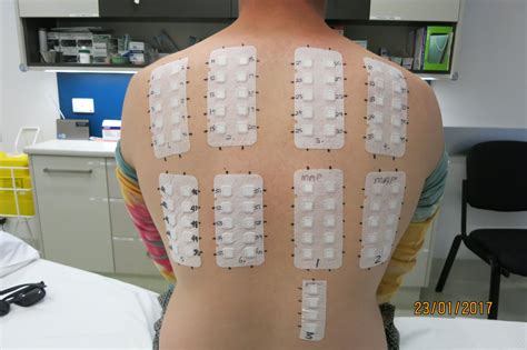 Safety and Testing: Patch Tests Are Not Optional