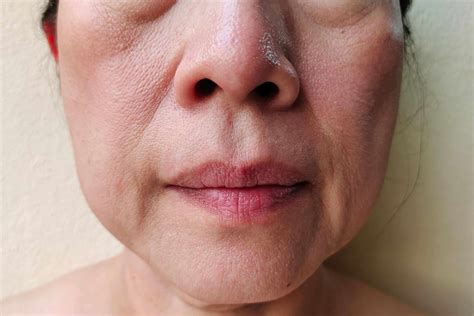 Farewell to Floppy Feet: Conquer Sagging Skin with these Expert Tips