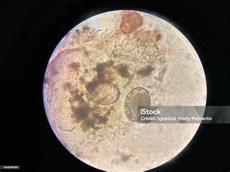 Scabies Eggs Under Microscope: Microscopic Views