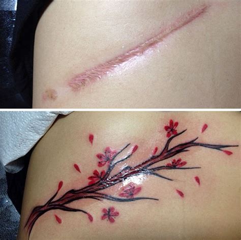 Scar Tattoos Tattoos Covering Scars Brings Beauty to