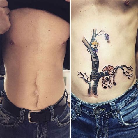 10+ Amazing Scar CoverUp Tattoos Part 12