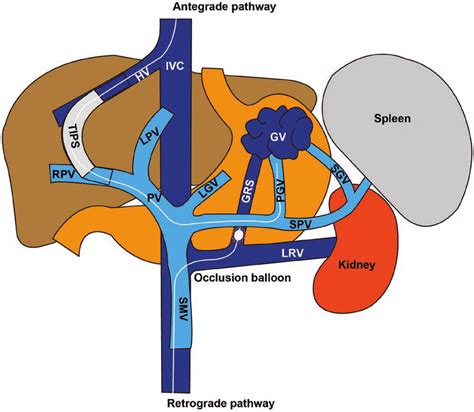 Schematic Diagram Tips