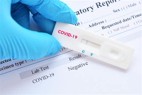 Coronavirus. Anche il kiwi positivo alla Covid19? Lo strano esperimento