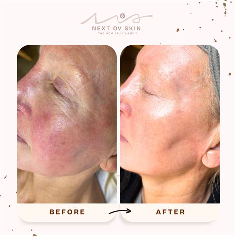 Seattle Skin & Laser Edmonds