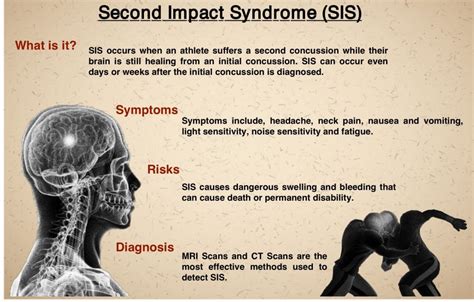 Second Impact Syndrome