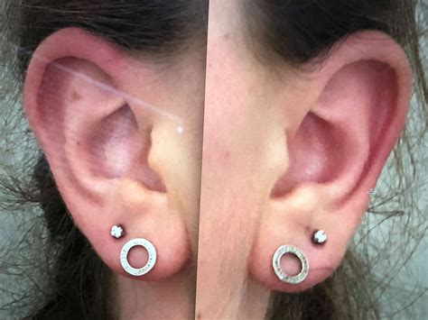 Seeking Professional Help for Uneven Ear Piercings