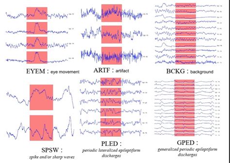 Sensasi dan pergerakan mengenai otak yang terdeteksi oleh EEG
