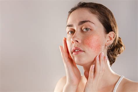 Sensitive Skin & Acne: Causes & Solutions