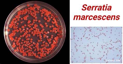 Serratia