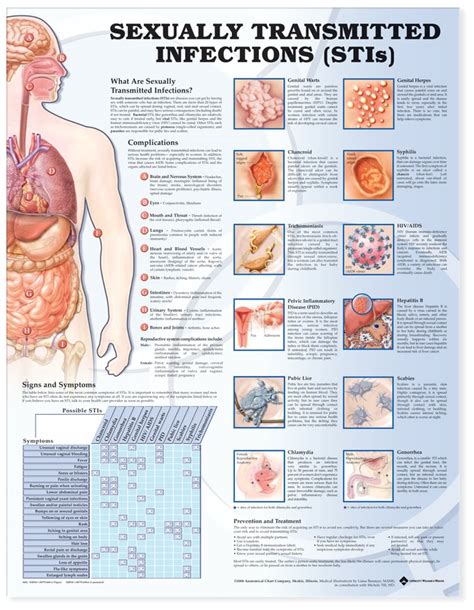 Sexually Transmitted Infection Chart