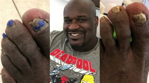 Shaquille O Neal Feet