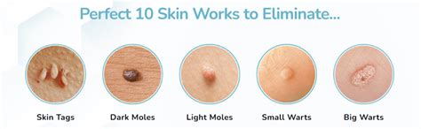 Unleash the Power of Shark Tank's Skin Tag Remover: The Secret to Flawless Skin Revealed!