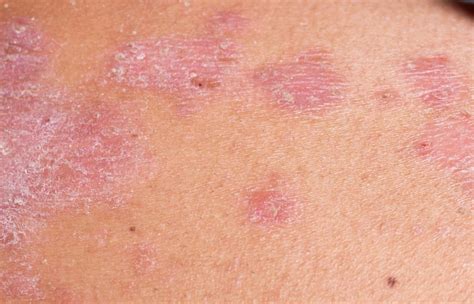 Unlocking the Secrets of a Shiny Penis Skin