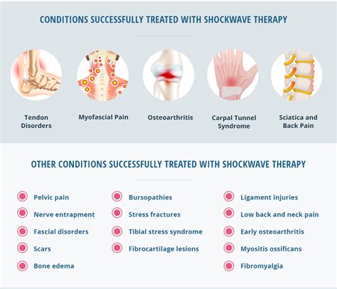Shockwave Therapy Benefits