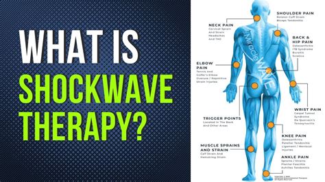 Shockwave Therapy in Oakland Explained