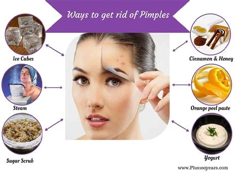 DIY home remedy to deal with acne food lovers
