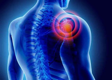 Shoulder Pain Relief Austin
